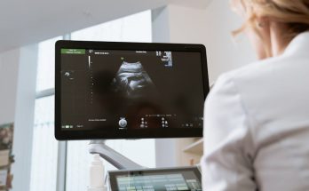 乳房硬塊的認識與處理：理性探討